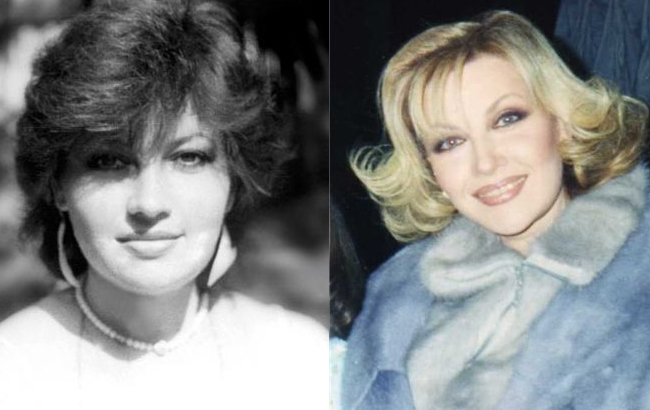 Стоп-кадр: як змінилися українські співачки після "уколів краси"