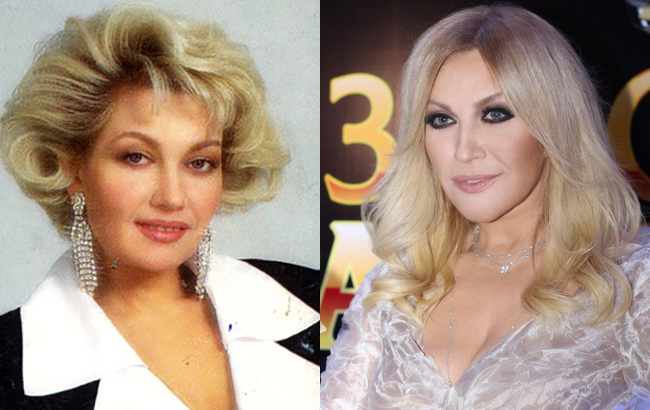 Стоп-кадр: як змінилися українські співачки після "уколів краси"