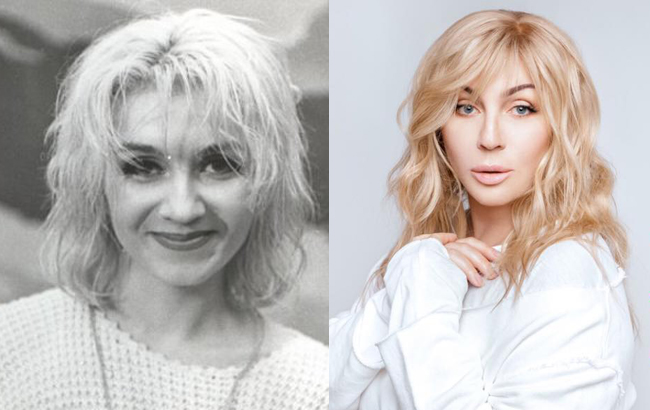 Стоп-кадр: як змінилися українські співачки після "уколів краси"