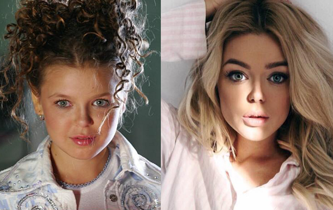 Стоп-кадр: як змінилися українські співачки після "уколів краси"