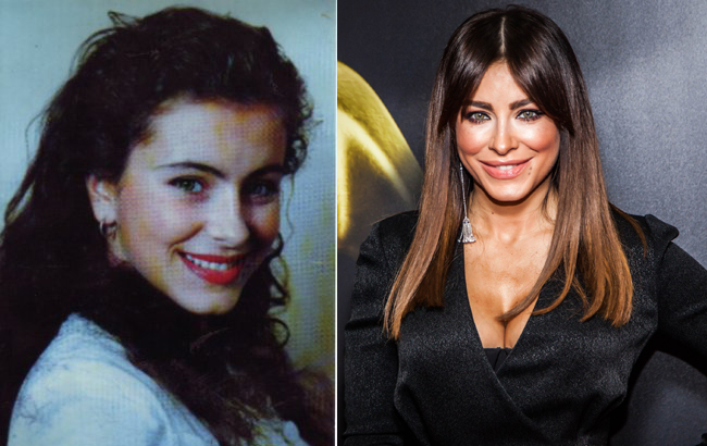 Стоп-кадр: як змінилися українські співачки після "уколів краси"