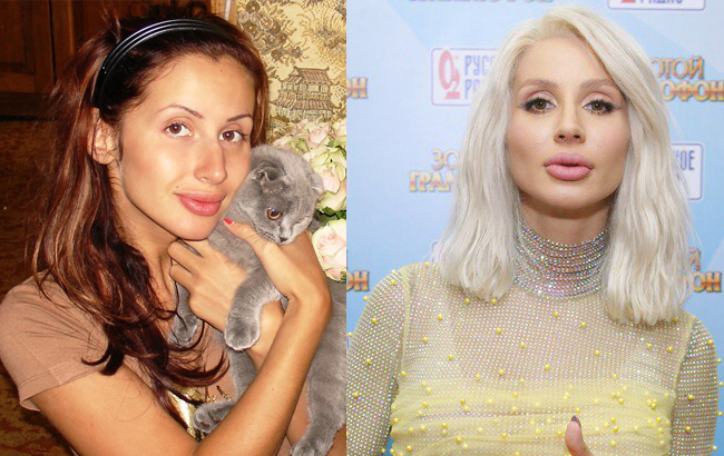 Стоп-кадр: як змінилися українські співачки після "уколів краси"