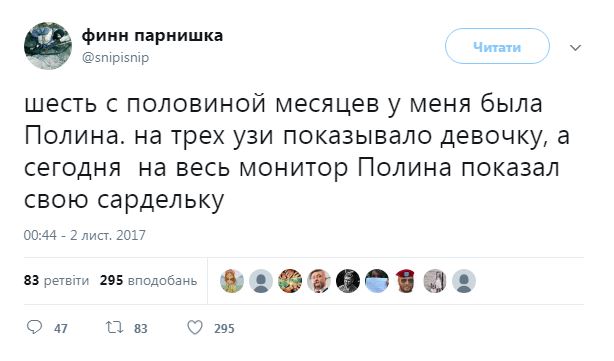 "Через два месяца рожать": очень юные супруги-бойцы АТО впечатлили сеть