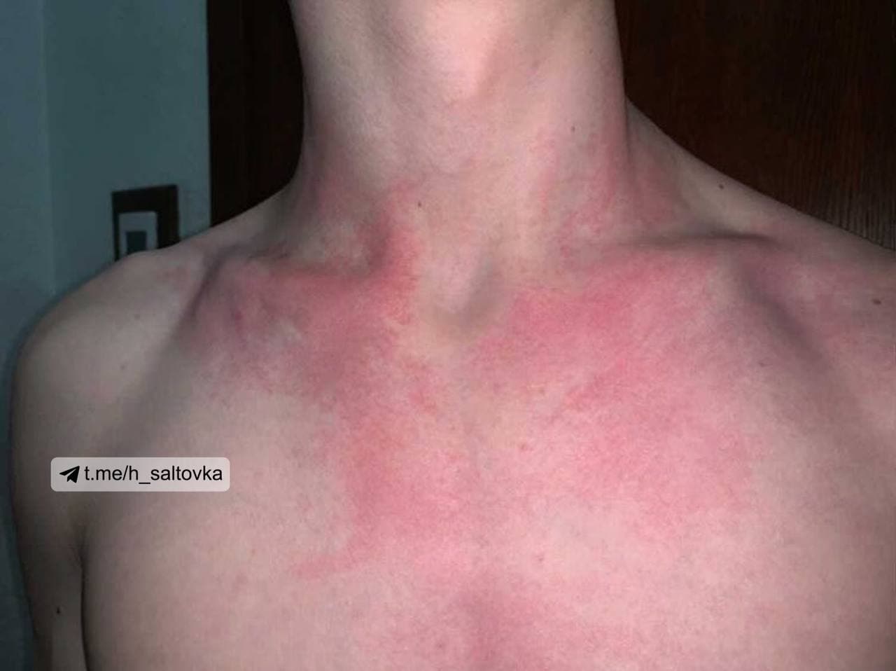 "Укрзалізниця" вляпалася в новий скандал: пасажири поскаржилися на укуси