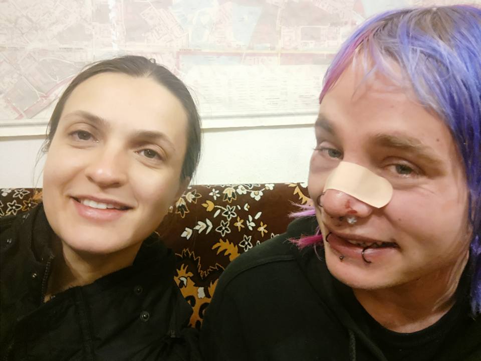 Удар по іміджу країни: в Києві на Водохреща побили іноземця