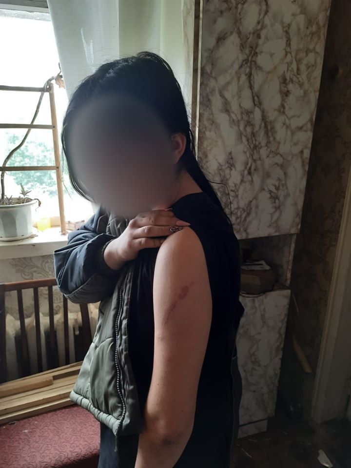 На Донбасі "копи" врятували дівчинку від горе-матері: дитину виховували ланцюгом