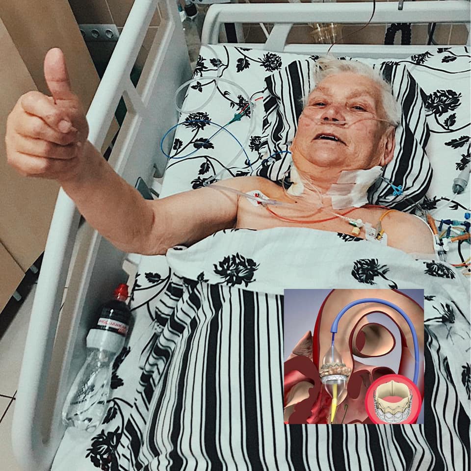 У Львові провели унікальну операцію на серці: без єдиного розрізу