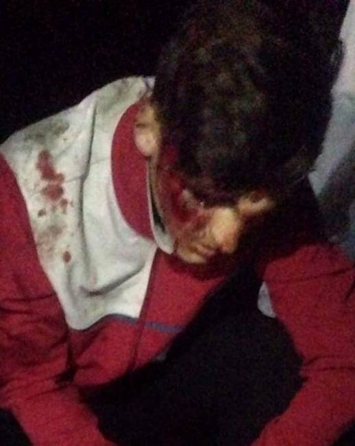 У Харківській області невідомі з кийками б'ють перехожих (фото)