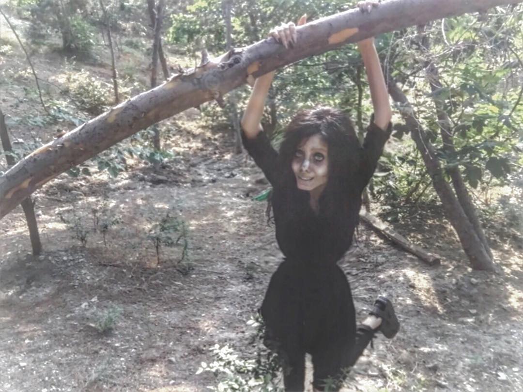 Дівчина пережила 50 операцій, щоб стати схожою на Джолі: ось що з цього вийшло