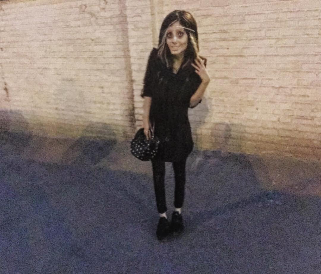 Дівчина пережила 50 операцій, щоб стати схожою на Джолі: ось що з цього вийшло