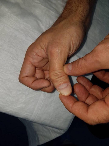 Шовковський показав жахливі травми після 35-річної футбольної кар'єри (фото)