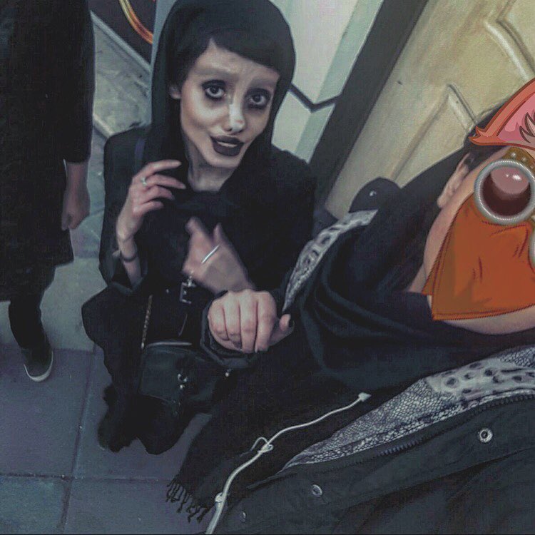 Дівчина пережила 50 операцій, щоб стати схожою на Джолі: ось що з цього вийшло