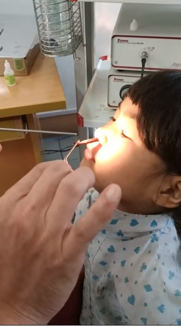 Оно шевелится: доктор извлек из шестилетней девочки нечто омерзительное (видео)