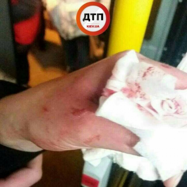 У Києві автобус з пасажирами закидали камінням