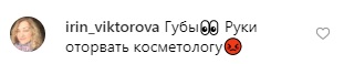 Любимая певица Януковича после пластики испугала киевлян (видео)