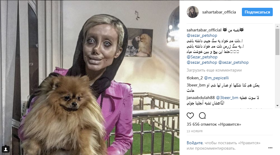 Стало известно, как выглядела до операций подражательница Джоли