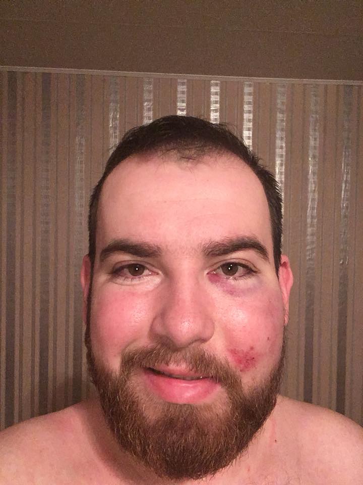 "Заламали і викинули на вулицю": в мережі розповіли про обурливий випадок у київському барі