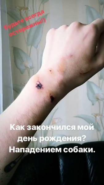 На представника України на Євробаченні 2018 напали в Лісабоні (фото)