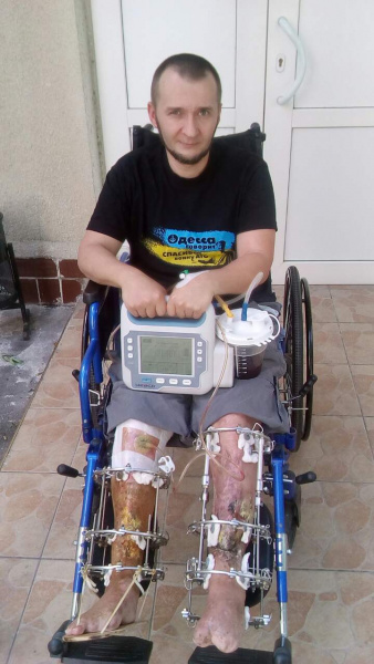 &quot;Поступок настоящего мужчины&quot;: волонтеры ищут средства на лечение раненого бойца