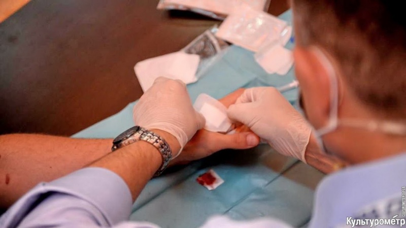 В Україні вперше імплантували людині чіп у руку