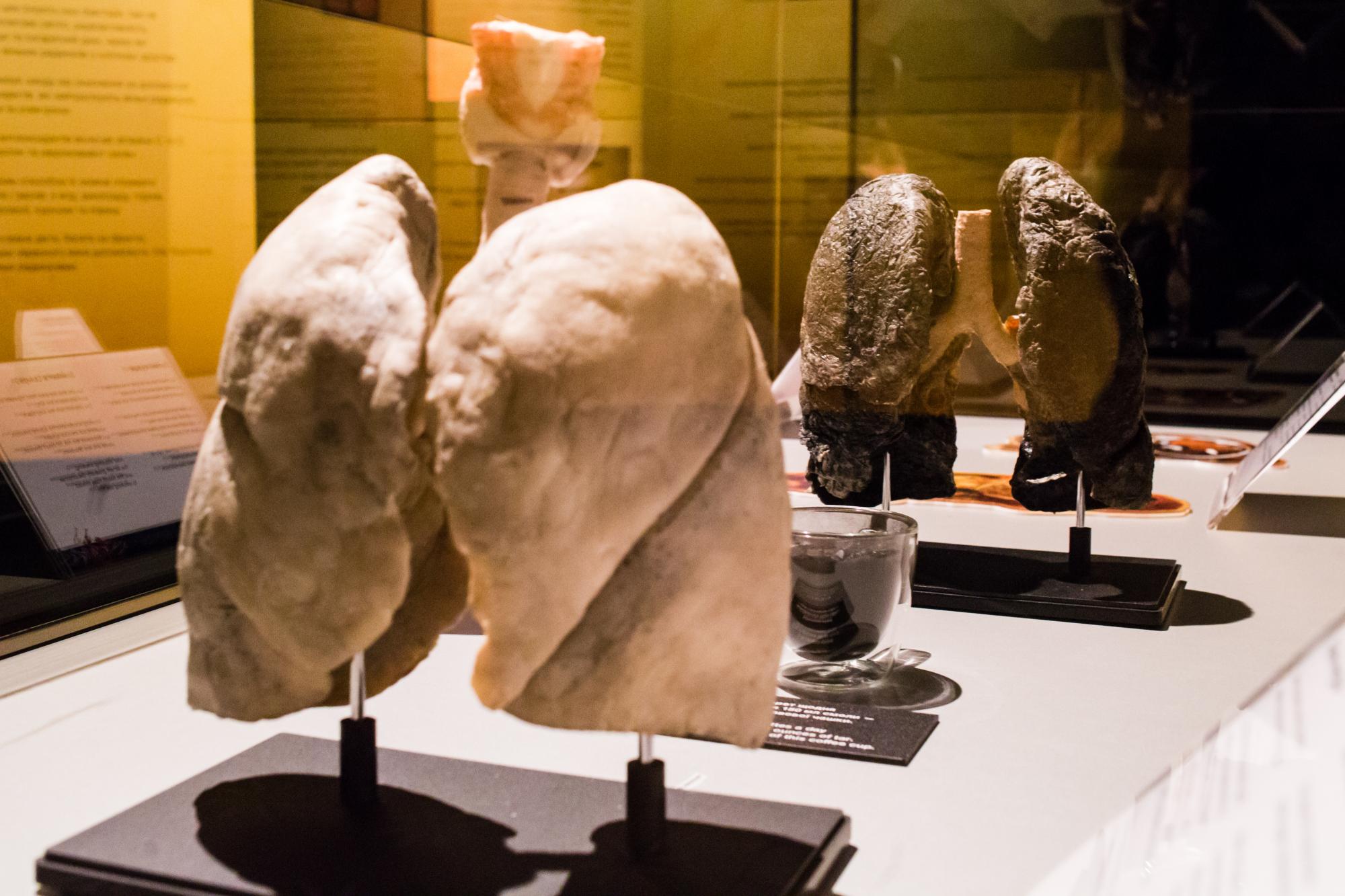 Выставка человеческих органов