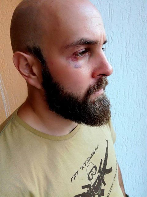 В Житомире избили инструктора по самообороне и самого обвинили в покушении на убийство