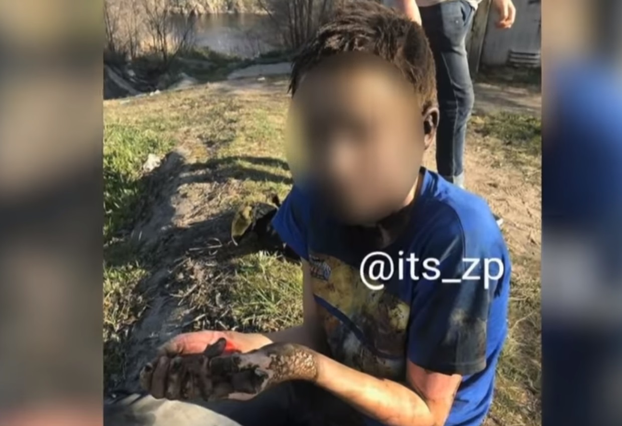 Настоящее чудо: школьник выжил после поражения 10 тыс. вольт