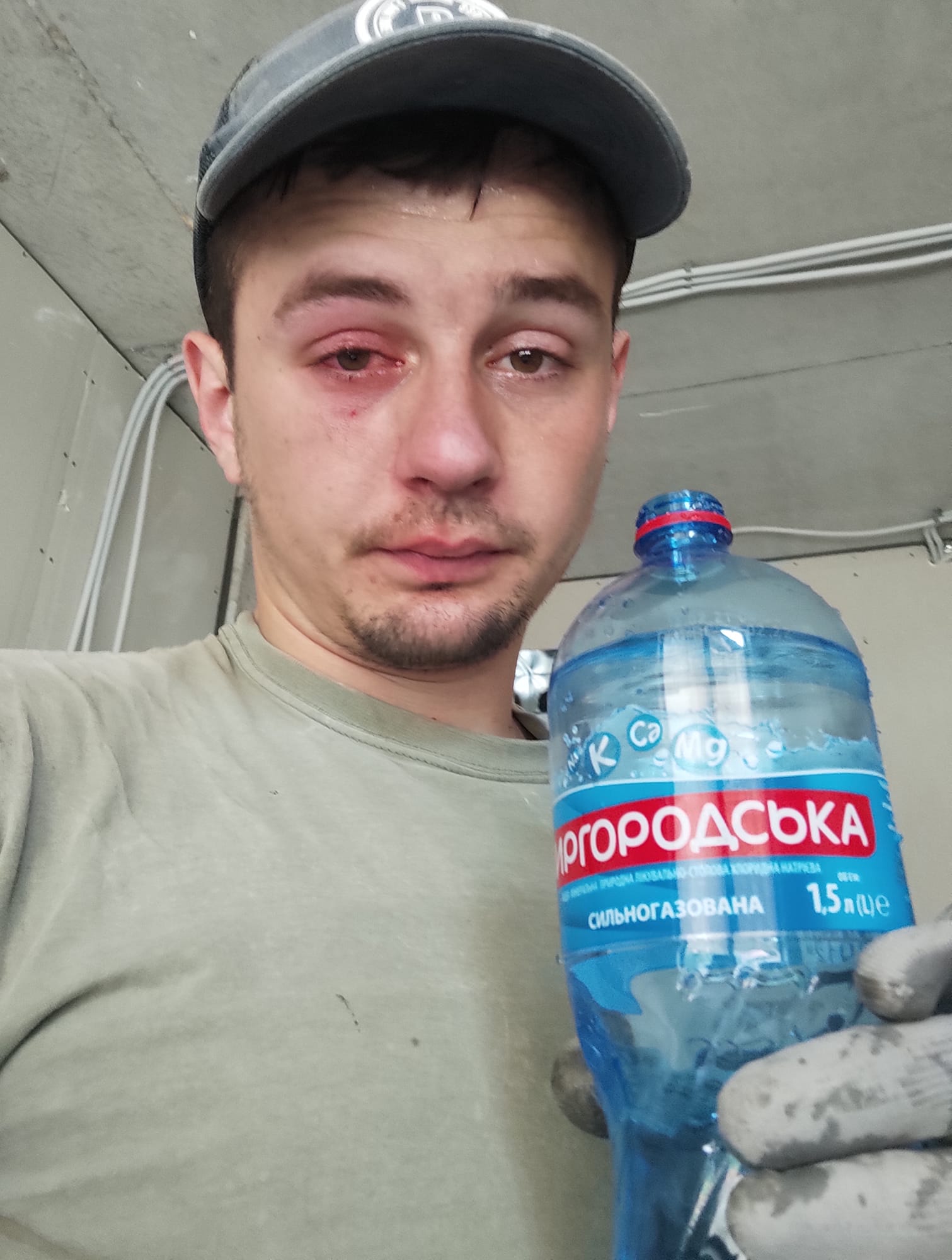 Во Львове парень едва не потерял глаз из-за бутылки минералки: что произошло (фото)