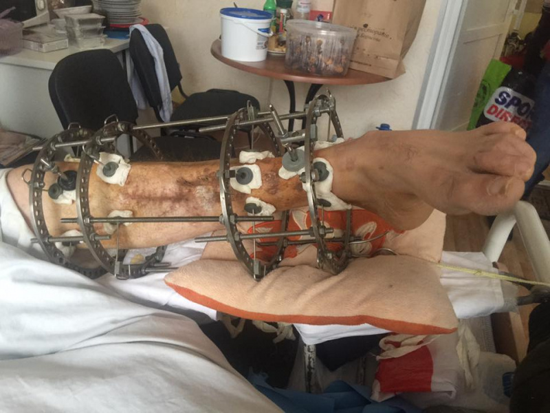 "Придите и скажите им спасибо": волонтер призвала не забывать о раненых бойцах АТО