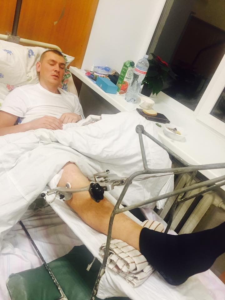 "Новости с передовой неутешительные": волонтер просит помочь тяжелораненым бойцам АТО