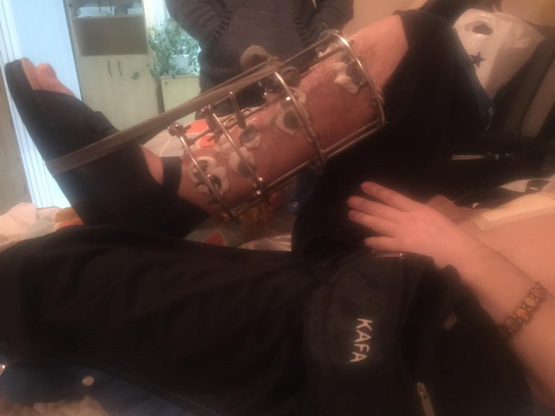 "Придите и скажите им спасибо": волонтер призвала не забывать о раненых бойцах АТО