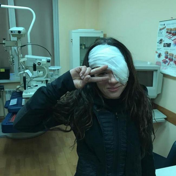 Руслана перенесла серьезную операцию на лице