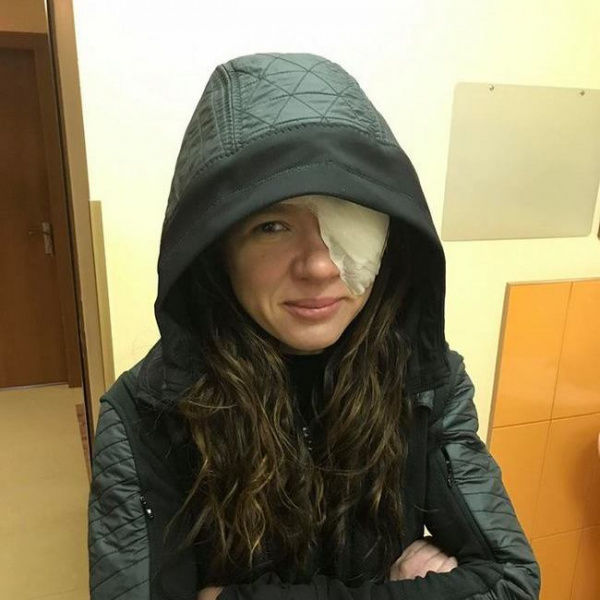 Руслана перенесла серьезную операцию на лице