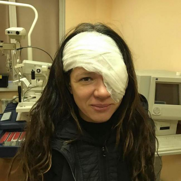 Руслана перенесла серьезную операцию на лице