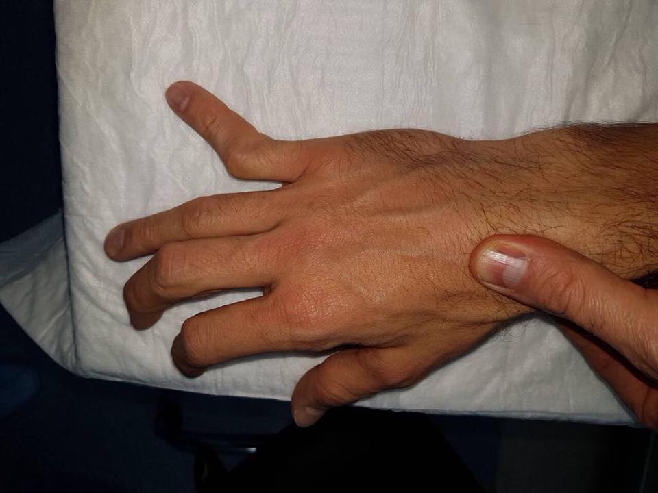 Шовковський показав жахливі травми після 35-річної футбольної кар'єри (фото)