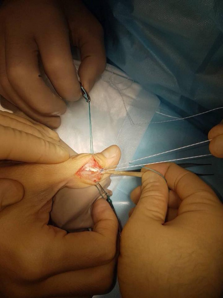 Шовковський показав жахливі травми після 35-річної футбольної кар'єри (фото)