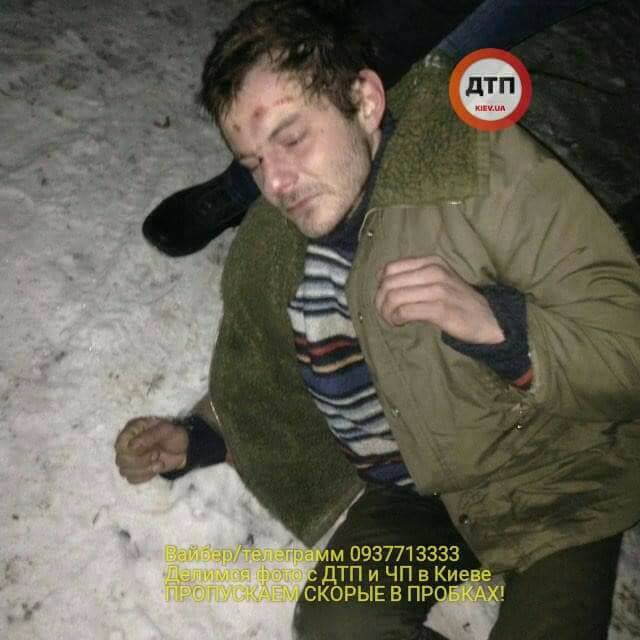 &quot;Насправді все було не так&quot;: лікарі пояснили ситуацію з хлопцем, який замерзав