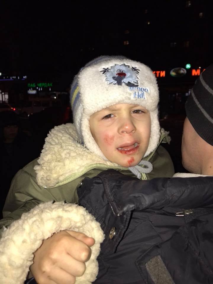 "Поліція нічого не говорить": у Києві жінка-водій збила матір з дитиною