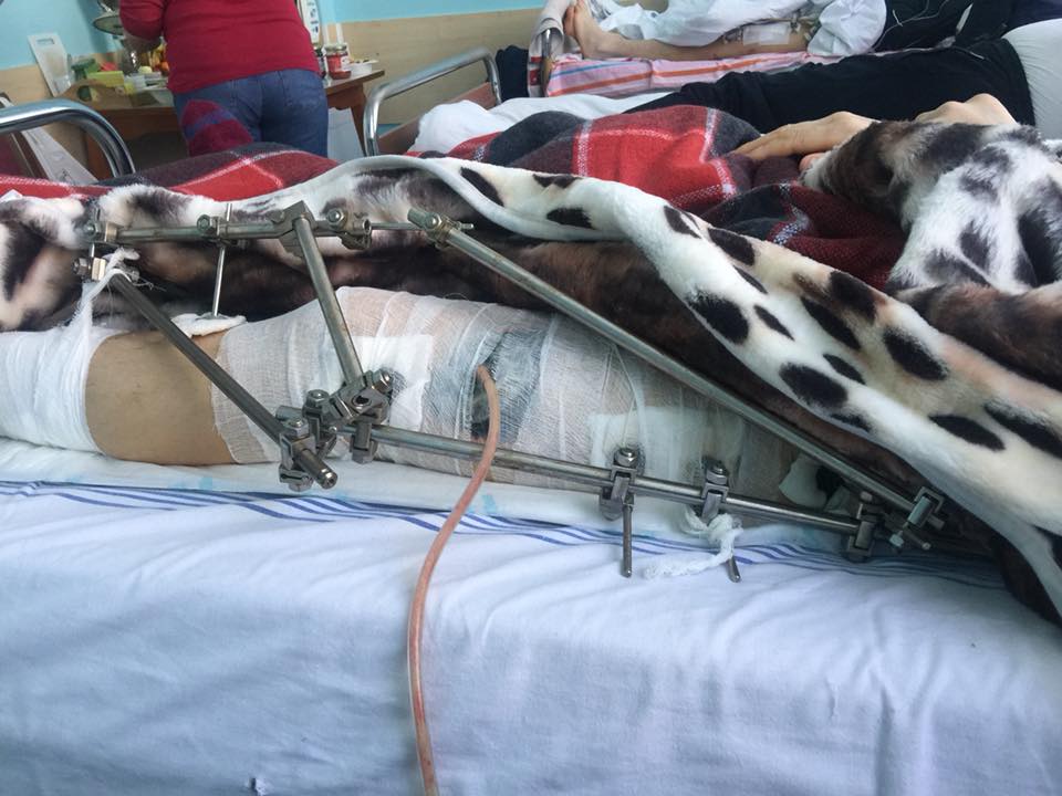 Некоторым едва 20 лет: украинцев просят помочь раненым бойцам АТО