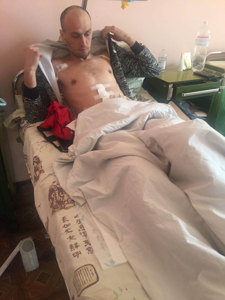 Некоторым едва 20 лет: украинцев просят помочь раненым бойцам АТО