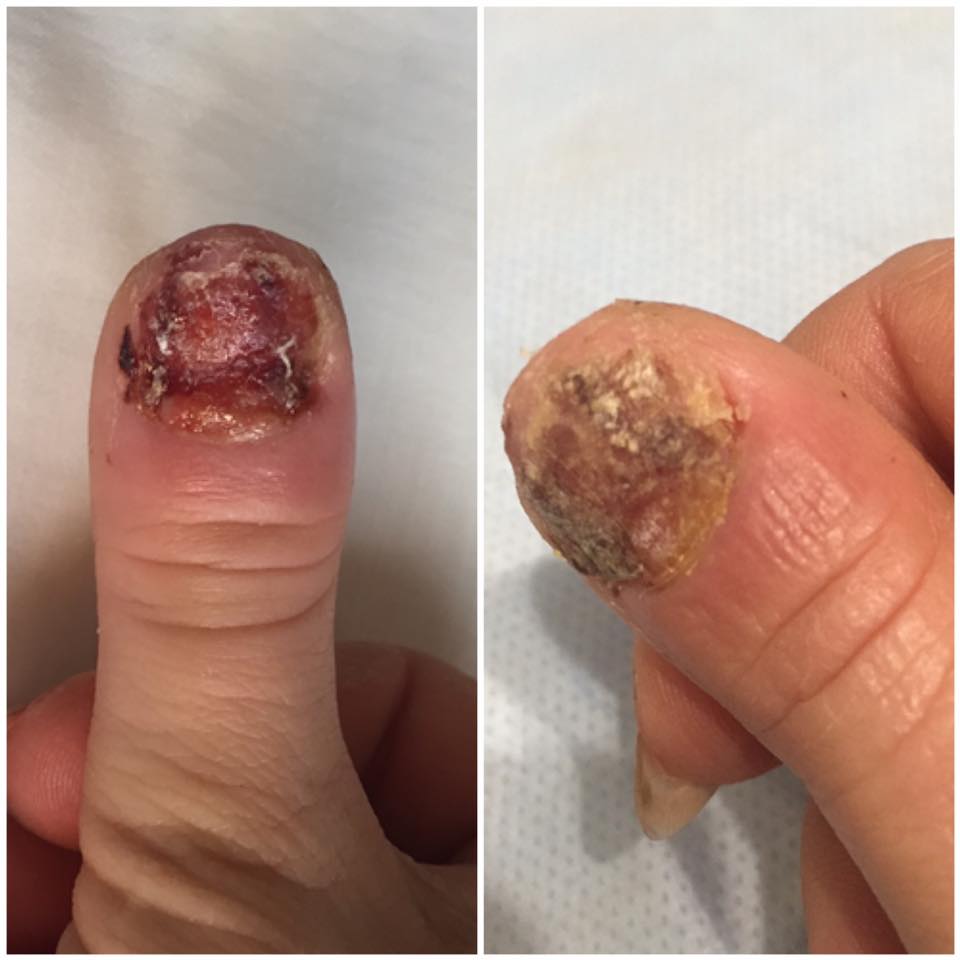 Мешканка Бердянська розповіла страшну історію про відвідування манікюрного салону