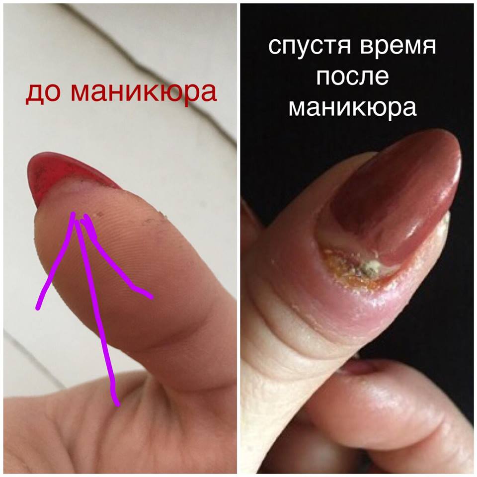 Мешканка Бердянська розповіла страшну історію про відвідування манікюрного салону