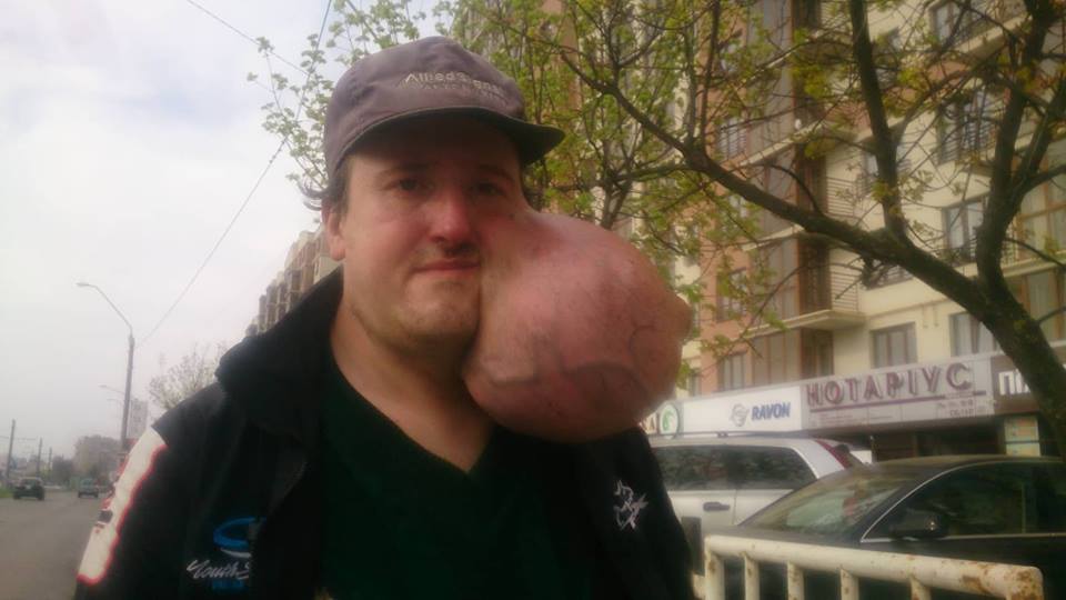 Потрібна допомога лікарів: у Львові волонтер просить допомогти хворому чоловікові