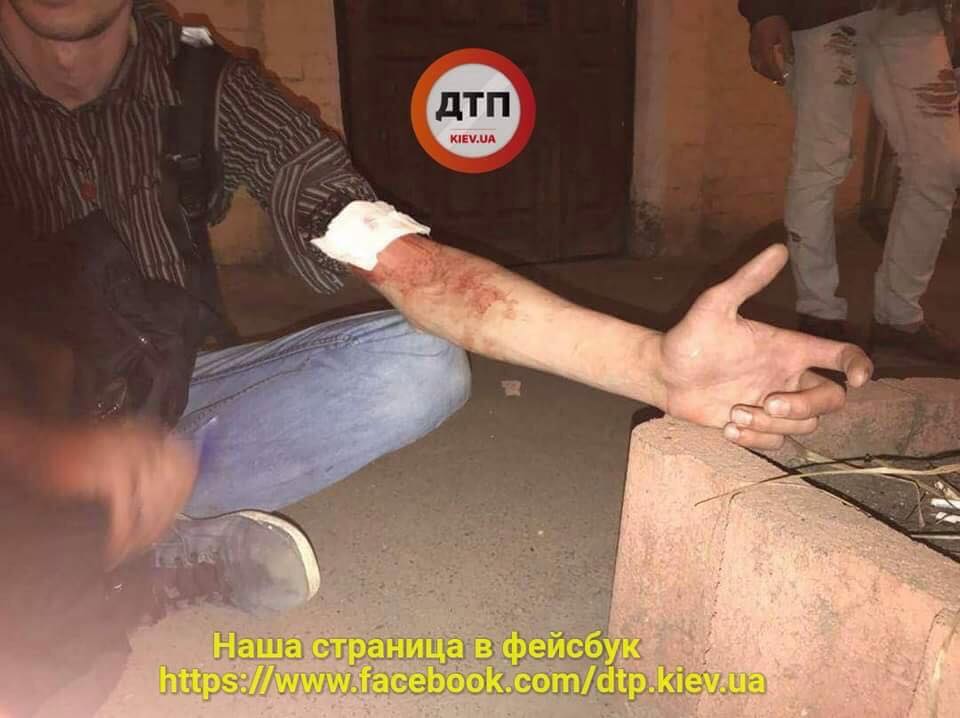 В троллейбусе Киева произошла поножовщина (фото)