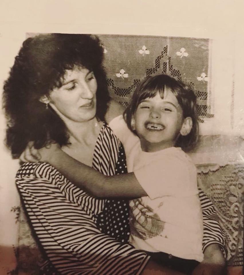 "Падіння було фронтальним": Лобода показала своє "беззубе" фото