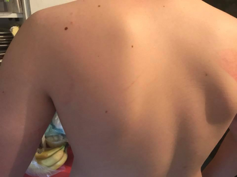 "Новий підхід у вихованні?": у столичній гімназії побили учня (фото)