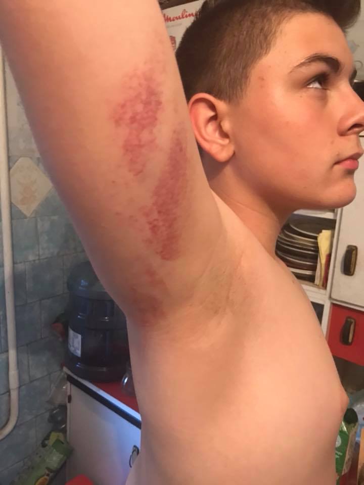 "Новий підхід у вихованні?": у столичній гімназії побили учня (фото)