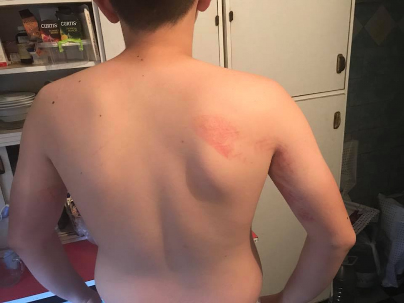 "Новий підхід у вихованні?": у столичній гімназії побили учня (фото)