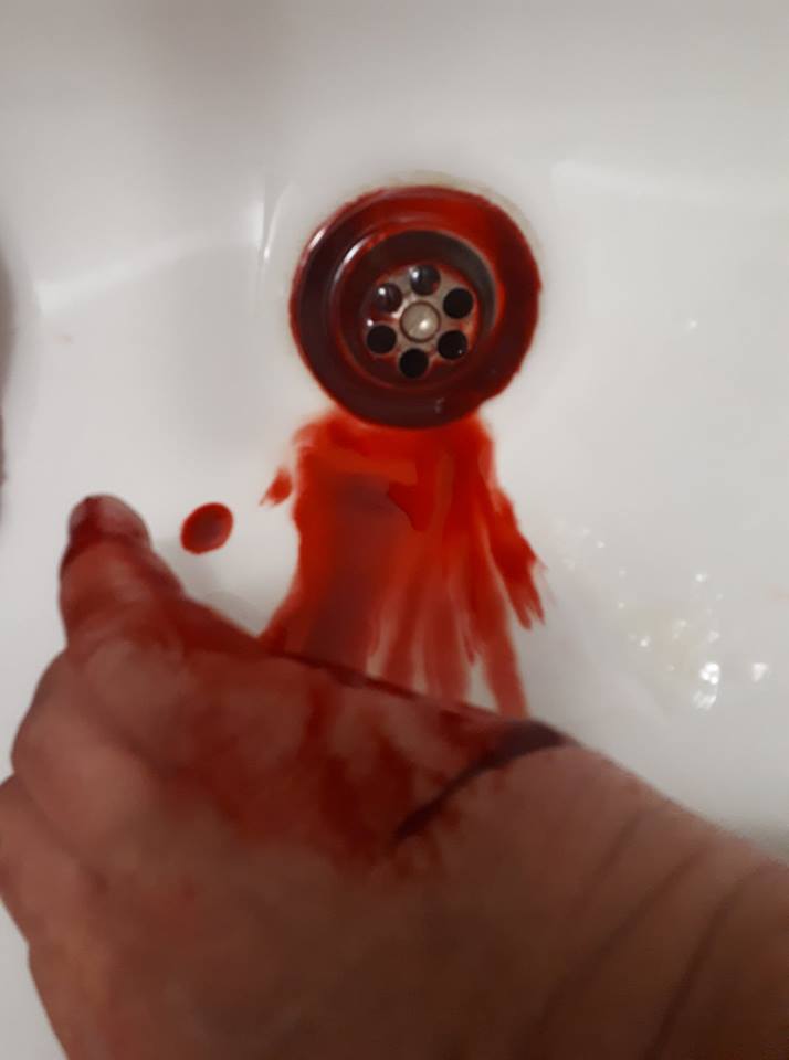 "Ждал меня у подъезда": Александр Ягольник рассказал детали нападения на него