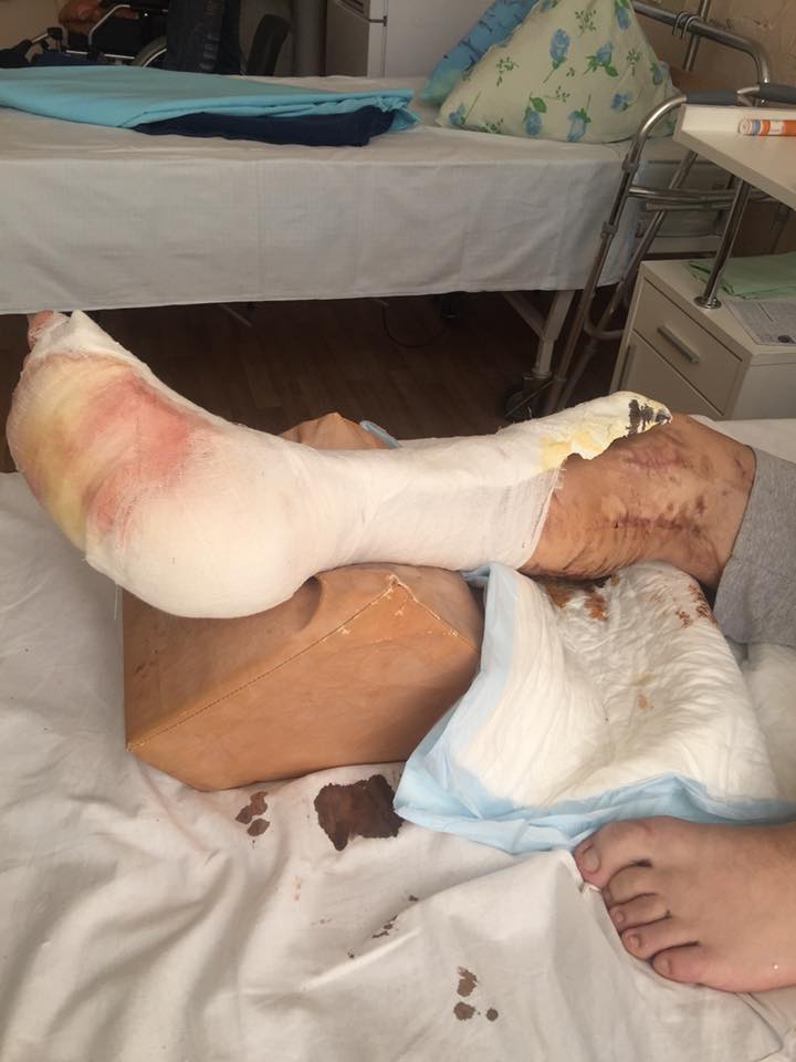 "Новый борт с ранеными": волонтер призвала помочь бойцам в киевском госпитале